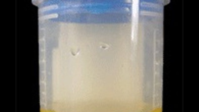 Synthetic Urine For 
      Women Horizon View Grand Junction CO